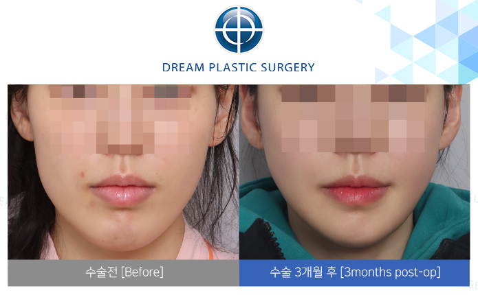 관련이미지