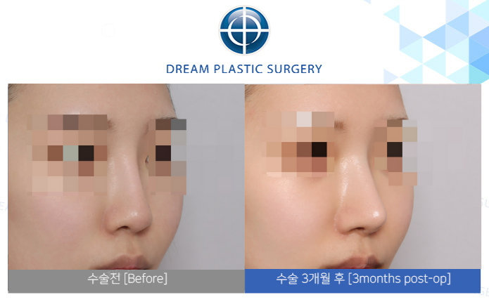 관련이미지