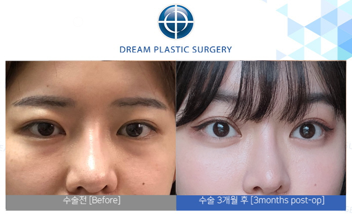 관련이미지